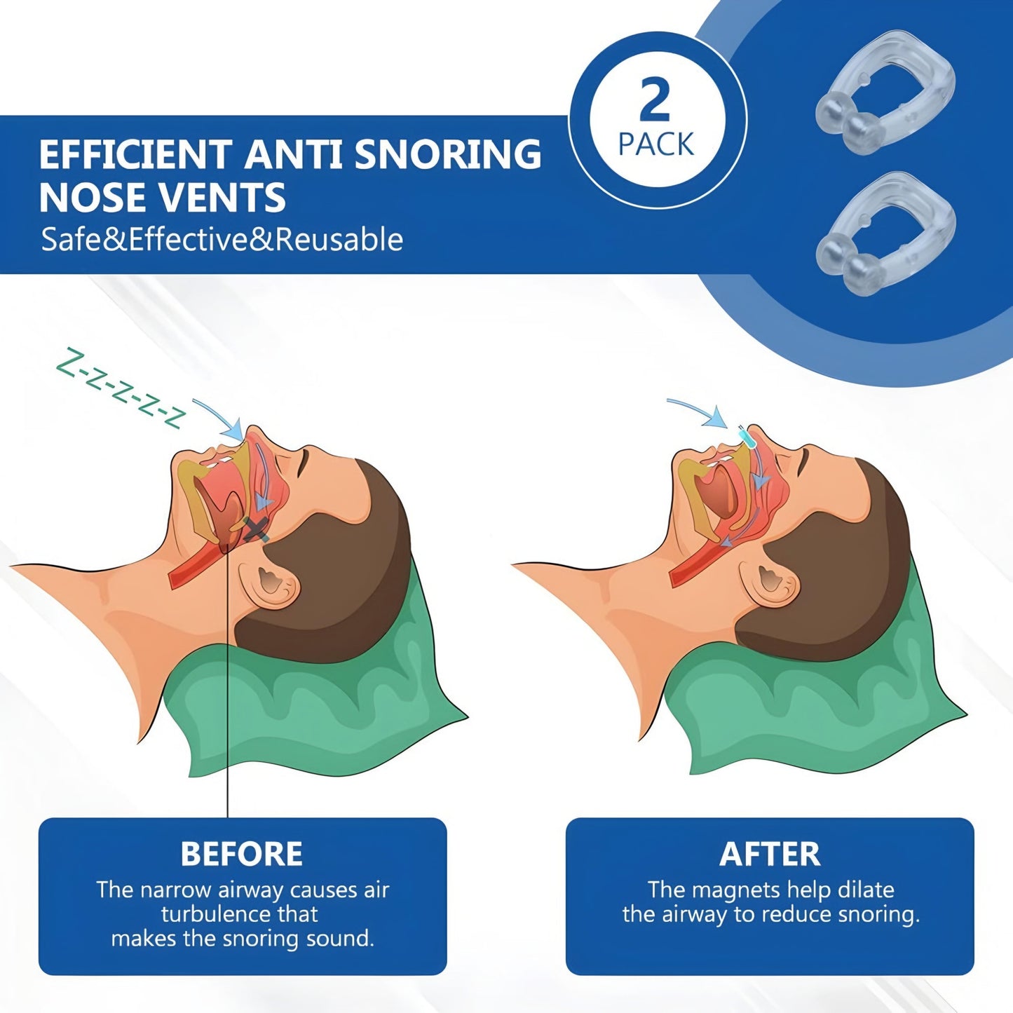 High-Quality Portable Anti Snoring Device for Men and Women