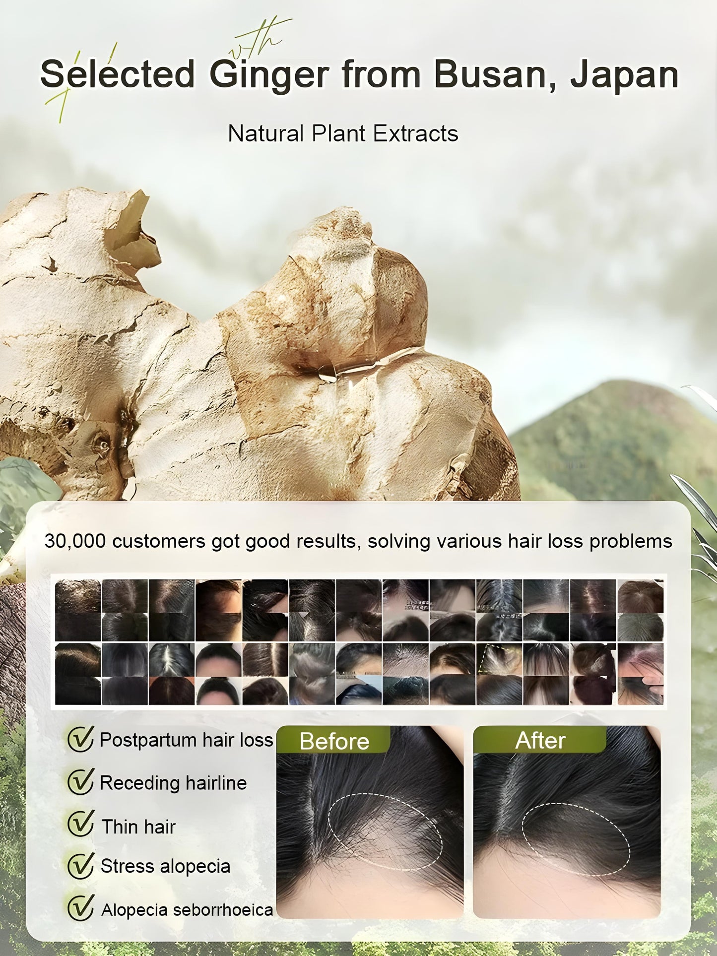 BUY 1 GET 1 FREE - Hot Sale Ginger Plant Extract Anti-Hair Loss Hair Shampoo