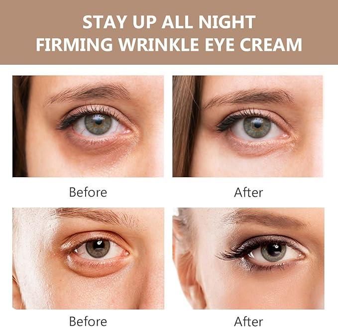 Last Day 50% OFF🎁 - Instant FIRM Eye Tightener & Eye Care Cream🎁